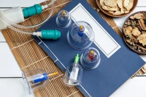 حجامت چیست ؟ و نحوه انجام آن